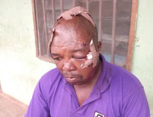 Armed Militias attacked 2 Plateau state IDPs