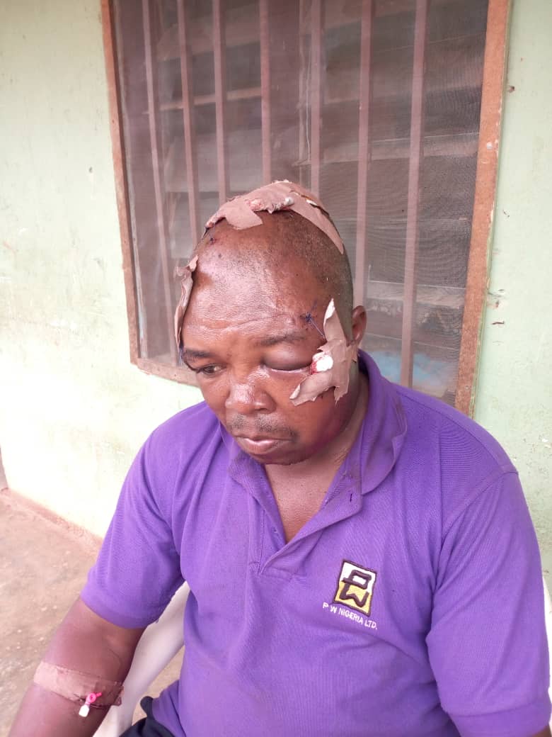 You are currently viewing Armed Militias attacked 2 Plateau state IDPs