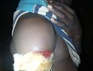 Fulani herders ambushed  5 locals of Jol community, Riyom LGA of Plateau