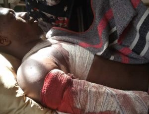Two Natives attacked by suspected Fulani Militia in Riyom LG of Plateau State
